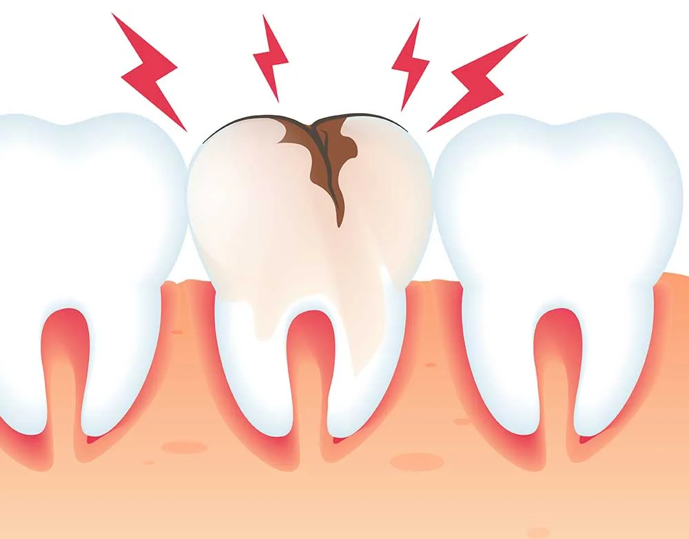 dental emergecny happpend with teeth