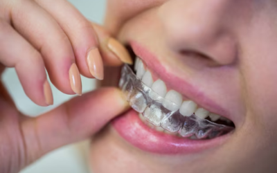 Dental Procedures Demystified
